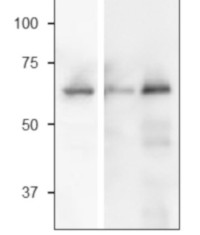 SiR | Sulfite reductase [ferredoxin], chloroplastic in the group Antibodies Plant/Algal  / DNA/RNA/Cell Cycle / Transcription regulation at Agrisera AB (Antibodies for research) (AS20 4424)